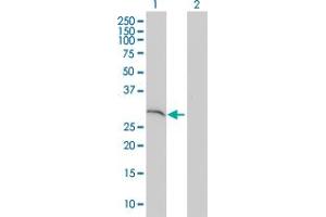 Western Blot analysis of SNAP29 expression in transfected 293T cell line by SNAP29 monoclonal antibody (M01), clone 3E4-E6. (SNAP29 antibody  (AA 1-258))