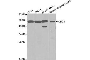 Western Blotting (WB) image for anti-Ornithine Decarboxylase 1 (ODC1) antibody (ABIN1873996) (ODC1 antibody)