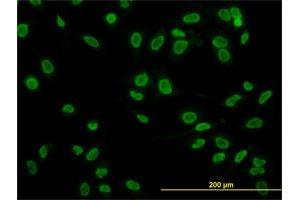 Immunofluorescence of monoclonal antibody to TAF11 on HeLa cell. (TAF11 antibody  (AA 158-210))