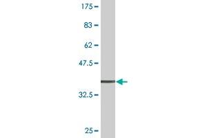 Western Blot detection against Immunogen (37. (ADAMDEC1 antibody  (AA 361-470))