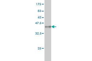 Western Blot detection against Immunogen (37. (STYK1 antibody  (AA 50-159))
