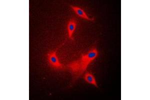 Immunofluorescent analysis of PPP2R1B staining in Raw264. (PPP2R1B antibody  (C-Term))