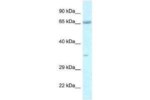 Western Blot showing Lzts1 antibody used at a concentration of 1. (LZTS1 antibody  (C-Term))