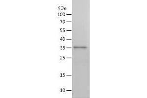 Western Blotting (WB) image for Lysine (K)-Specific Demethylase 2A (KDM2A) (AA 369-649) protein (His tag) (ABIN7283012) (KDM2A Protein (AA 369-649) (His tag))
