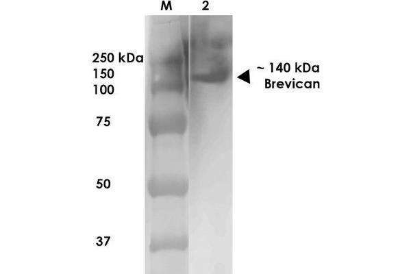 BCAN 抗体  (AA 219-655) (HRP)