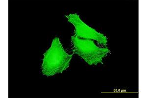 FBXL22 antibody  (AA 1-110)