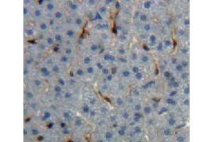 Used in DAB staining on fromalin fixed paraffin-embedded liver tissue (IGF1 antibody  (AA 33-102))