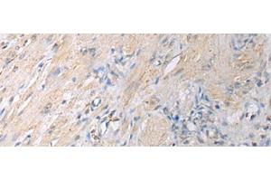 Immunohistochemistry (Paraffin-embedded Sections) (IHC (p)) image for anti-Guanine Nucleotide Binding Protein (G Protein), alpha Inhibiting Activity Polypeptide 1 (GNAI1) antibody (ABIN7247801)