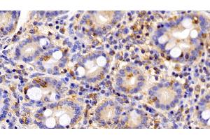 Immunohistochemistry (IHC) image for anti-Leptin Receptor (LEPR) (AA 310-539) antibody (ABIN7430873)