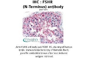 Image no. 1 for anti-Follicle Stimulating Hormone Receptor (FSHR) (Extracellular Domain), (N-Term) antibody (ABIN1734473) (FSHR antibody  (Extracellular Domain, N-Term))