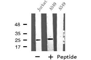 Western blot analysis of extracts from A549/Jurkat cells, using ARHGDIG antibody. (ARHGDIG antibody  (Internal Region))