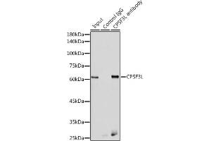 Immunoprecipitation analysis of 300 μg extracts of HeLa cells using 3 μg CPSF3L antibody (ABIN6130873, ABIN6138970, ABIN6138971 and ABIN6222240). (CPSF3L antibody  (AA 331-600))