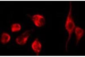 ABIN6275114 staining K562 by IF/ICC. (EPN3 antibody  (Internal Region))