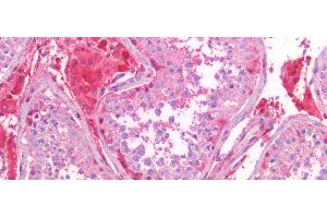 Detection of S100A6 in Human Testis Tissue using Polyclonal Antibody to S100 Calcium Binding Protein A6 (S100A6) (S100A6 antibody  (AA 1-90))