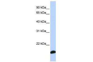 PRDX5 antibody used at 1 ug/ml to detect target protein. (Peroxiredoxin 5 antibody  (Middle Region))