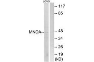 Western Blotting (WB) image for anti-Myeloid Cell Nuclear Differentiation Antigen (MNDA) (AA 358-407) antibody (ABIN2890426) (MNDA antibody  (AA 358-407))