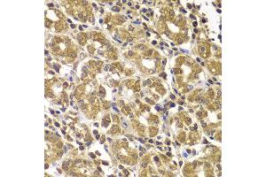 Immunohistochemistry of paraffin-embedded human gastric using HSPE1 antibody at dilution of 1:100 (x400 lens).