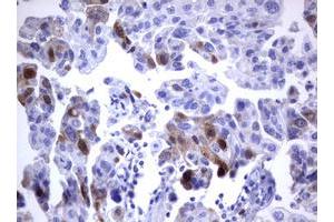 Image no. 3 for anti-Thymidylate Synthetase (TYMS) antibody (ABIN1501589)