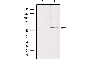 Western blot analysis of extracts from mouse brain, using SLC16A2 Antibody. (SLC16A2/MCT8 antibody  (Internal Region))