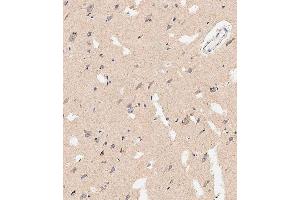 Immunohistochemical analysis of paraffin-embedded human brain tissue using E performed on the Leica® BOND RXm.