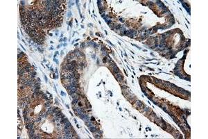 Immunohistochemical staining of paraffin-embedded Kidney tissue using anti-IFT57mouse monoclonal antibody.