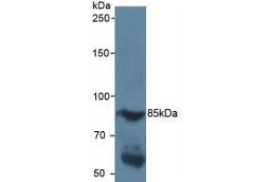 Detection of HIF1a in Human Serum using Polyclonal Antibody to Hypoxia Inducible Factor 1 Alpha (HIF1a) (HIF1A antibody  (AA 218-506))