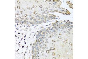 Immunohistochemistry of paraffin-embedded human esophagus using IL6 antibody at dilution of 1:100 (40x lens).