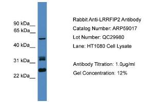 WB Suggested Anti-LRRFIP2  Antibody Titration: 0. (LRRFIP2 antibody  (N-Term))