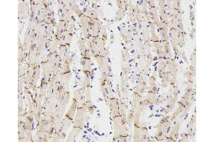 Immunohistochemistry analysis of paraffin-embedded rat heart using Connexin 43 Polyclonal Antibody at dilution of 1:300. (Connexin 43/GJA1 antibody)