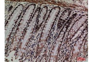 Immunohistochemistry (IHC) analysis of paraffin-embedded Human Colon, antibody was diluted at 1:100. (MCM3 antibody  (Internal Region))