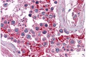 Human Testis: Formalin-Fixed, Paraffin-Embedded (FFPE) (BIRC3 antibody  (AA 314-508))