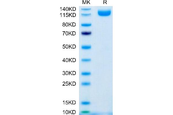 IL31RA Protein (AA 20-519) (Fc Tag)