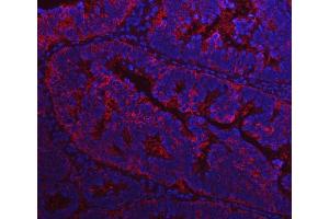 IF analysis of FASN using anti-FASN antibody (ABIN3044520).