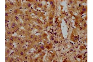 IHC image of ABIN7154041 diluted at 1:300 and staining in paraffin-embedded human liver tissue performed on a Leica BondTM system. (PET112L antibody  (AA 301-383))