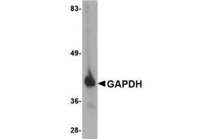 Image no. 1 for anti-Glyceraldehyde-3-Phosphate Dehydrogenase (GAPDH) (C-Term) antibody (ABIN341733) (GAPDH antibody  (C-Term))