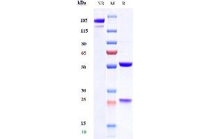 Anti- Human TSLP( Tezepelumab) on SDS-PAGE under reducing (R) condition. (Recombinant TSLP (Tezepelumab Biosimilar) antibody)