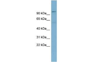 WB Suggested Anti-TBL3  Antibody Titration: 0.