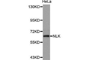 Western Blotting (WB) image for anti-Nemo-Like Kinase (NLK) (AA 278-527) antibody (ABIN6220150) (Nemo-Like Kinase antibody  (AA 278-527))