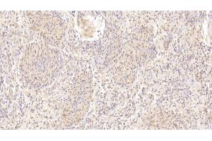 Detection of CDH23 in Human Spleen Tissue using Polyclonal Antibody to Cadherin 23 (CDH23) (CDH23 antibody  (AA 34-236))