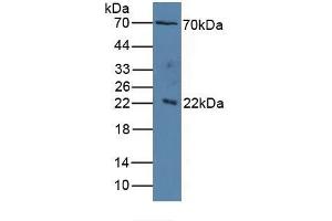 Detection of IL1RAP in Human Serum using Polyclonal Antibody to Interleukin 1 Receptor Accessory Protein (IL1RAP) (IL1RAP antibody  (AA 420-558))