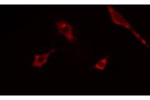 ABIN6268898 staining COLO205  cells by IF/ICC. (ACTG2 antibody  (N-Term))