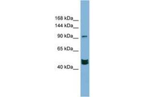 Image no. 1 for anti-Mastermind-Like 3 (MAML3) (AA 791-840) antibody (ABIN6742125) (MAML3 antibody  (AA 791-840))