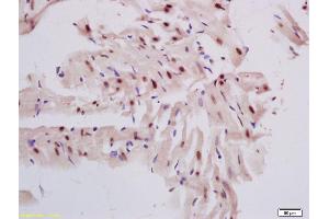 Formalin-fixed and paraffin embedded rat heart labeled with Rabbit Anti DNase gamma Polyclonal Antibody, Unconjugated (ABIN872726) at 1:200 followed by conjugation to the secondary antibody and DAB staining (DNASE1L3 antibody  (AA 151-250))