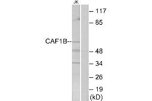Western blot analysis of extracts from Jurkat cells, using CAF1B antibody. (CHAF1A antibody)
