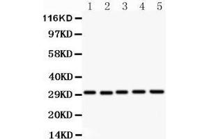 Western Blotting (WB) image for anti-CD82 (CD82) (AA 98-267) antibody (ABIN3043486)