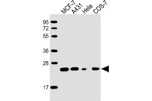 All lanes : Anti-RAB21 Antibody at 1:2000 dilution Lane 1: MCF-7 whole cell lysate Lane 2: A431 whole cell lysate Lane 3: Hela whole cell lysate Lane 4: COS-7 whole cell lysate Lysates/proteins at 20 μg per lane. (RAB21 antibody  (AA 1-225))