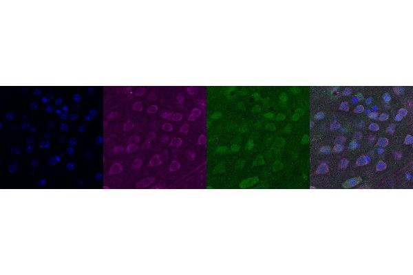 CHRNA6 antibody
