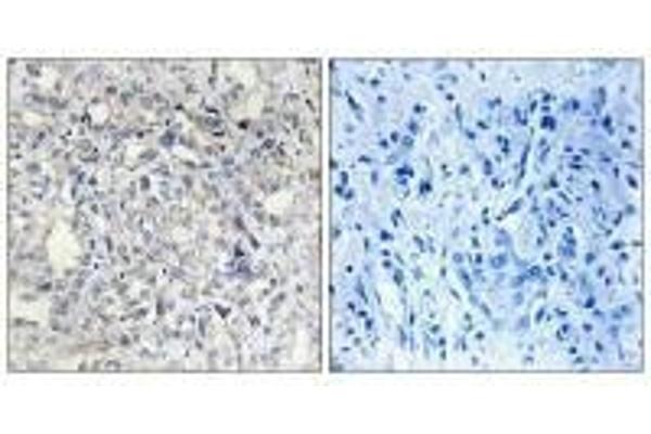 SERPIND1 antibody