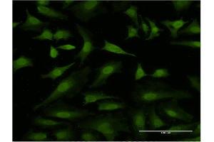 Immunofluorescence of monoclonal antibody to HEXIM1 on HeLa cell. (HEXIM1 antibody  (AA 1-359))