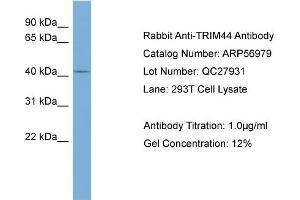 WB Suggested Anti-TRIM44  Antibody Titration: 0. (TRIM44 antibody  (Middle Region))